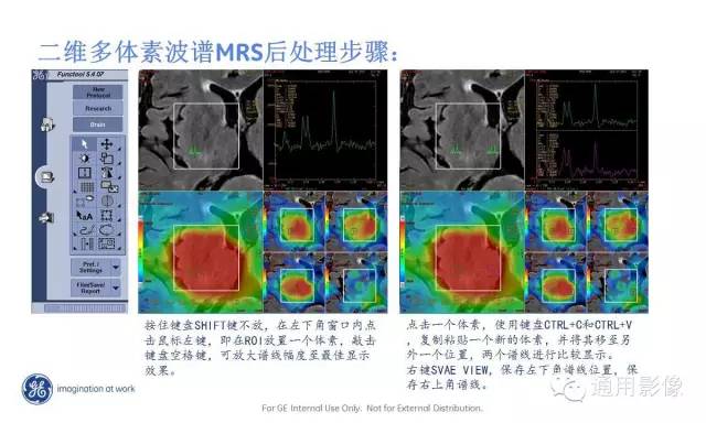 中枢神经系统波谱MRS