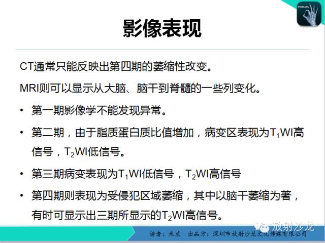 【PPT】Wallerian’s—华勒氏变性