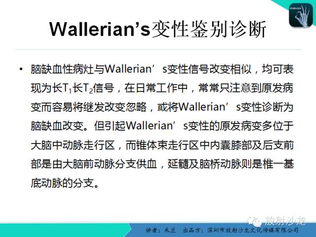 【PPT】Wallerian’s—华勒氏变性