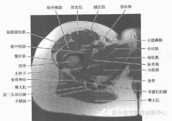 大腿解剖+详细标注