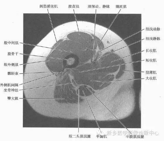 大腿解剖+详细标注