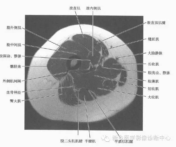 大腿解剖+详细标注