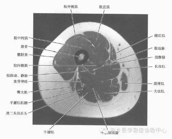 大腿解剖+详细标注