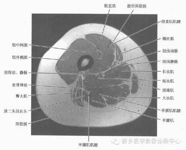大腿解剖+详细标注
