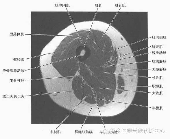 大腿解剖+详细标注