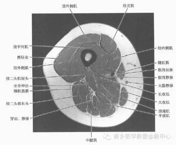 大腿解剖+详细标注