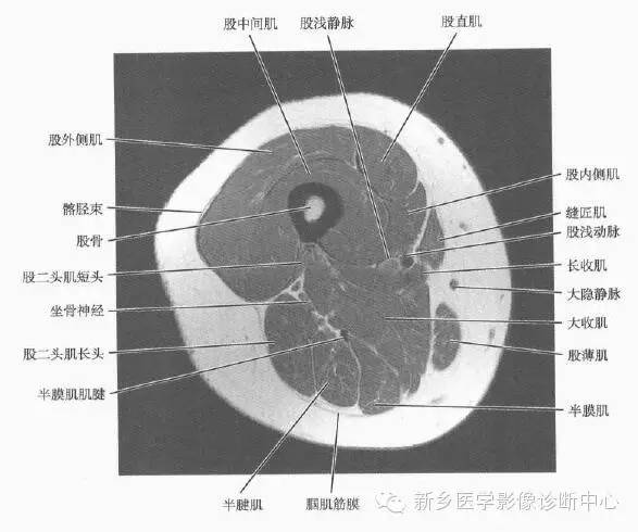 大腿解剖+详细标注