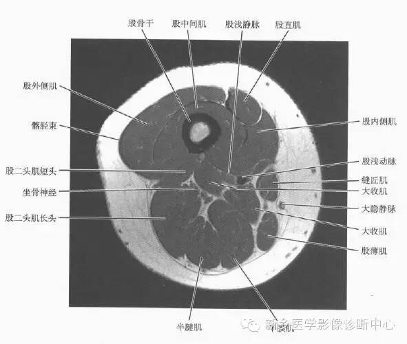 大腿解剖+详细标注