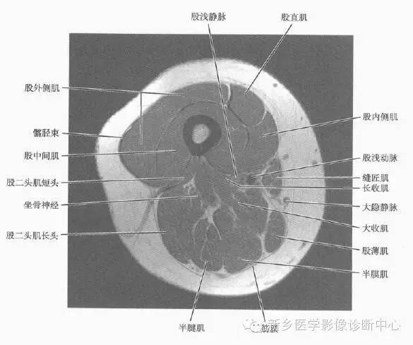 大腿解剖+详细标注