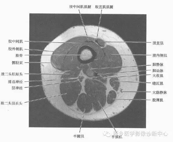 大腿解剖+详细标注