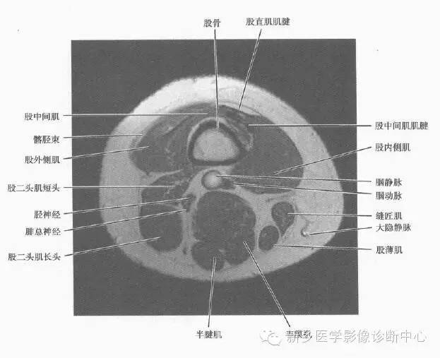 大腿解剖+详细标注