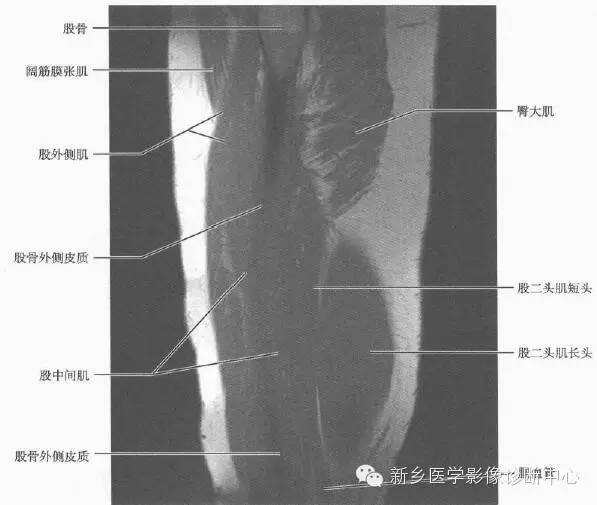 大腿解剖+详细标注