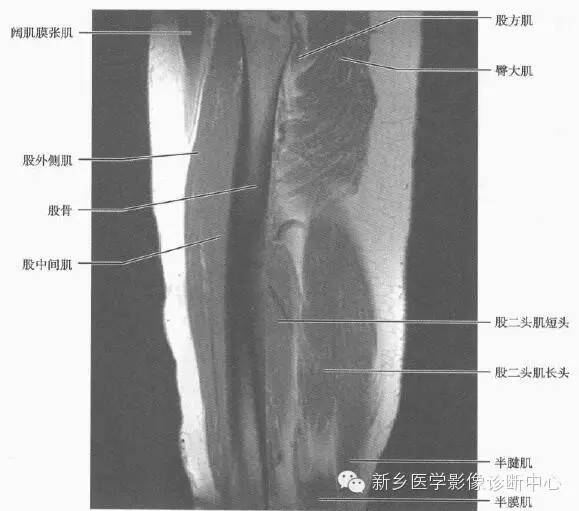 大腿解剖+详细标注