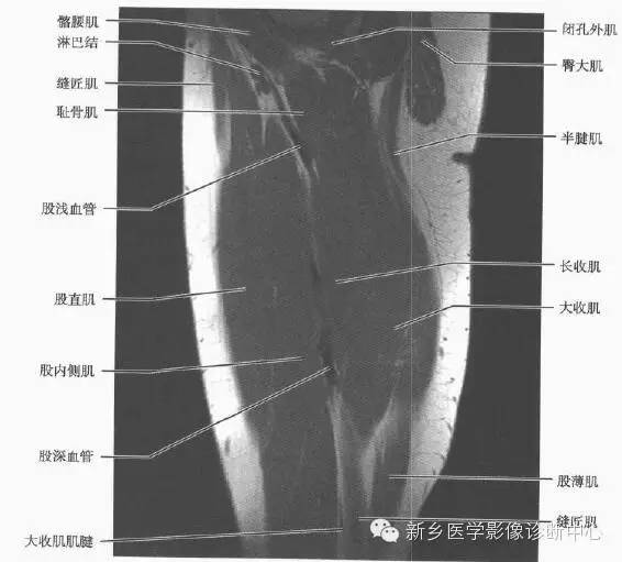 大腿解剖+详细标注