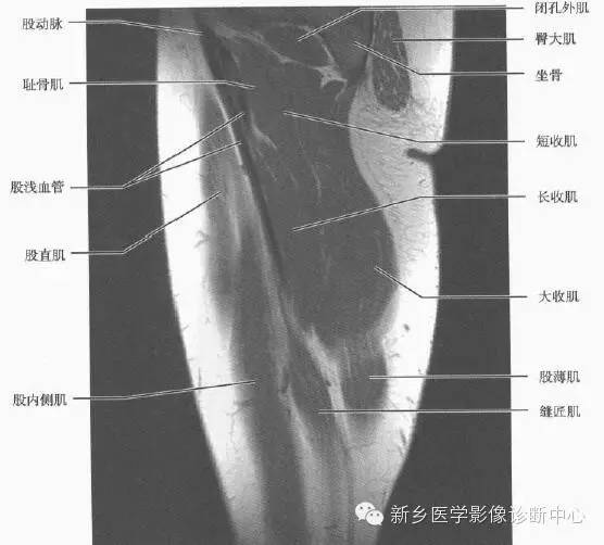 大腿解剖+详细标注