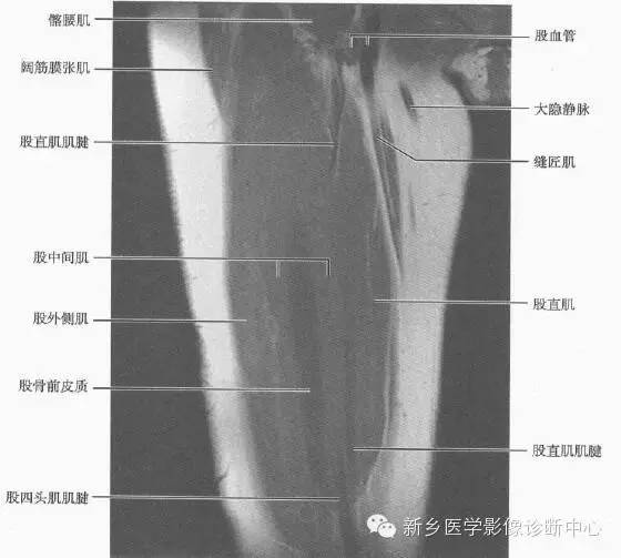 大腿解剖+详细标注