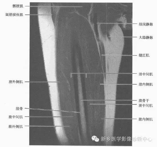 大腿解剖+详细标注
