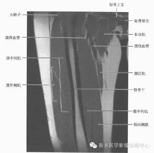 大腿解剖+详细标注