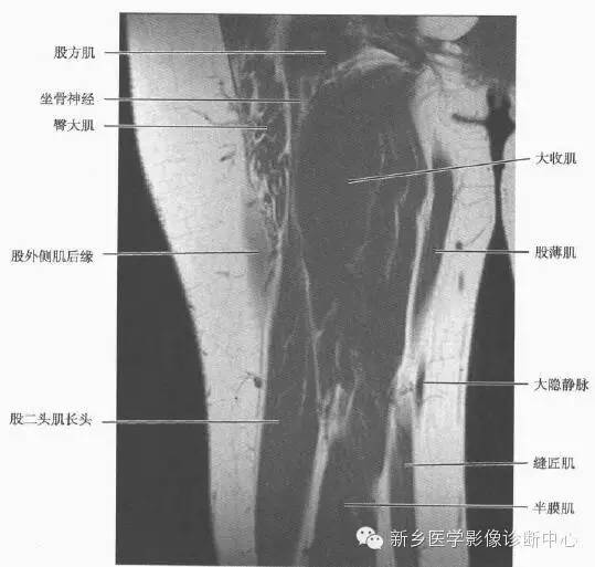 大腿解剖+详细标注