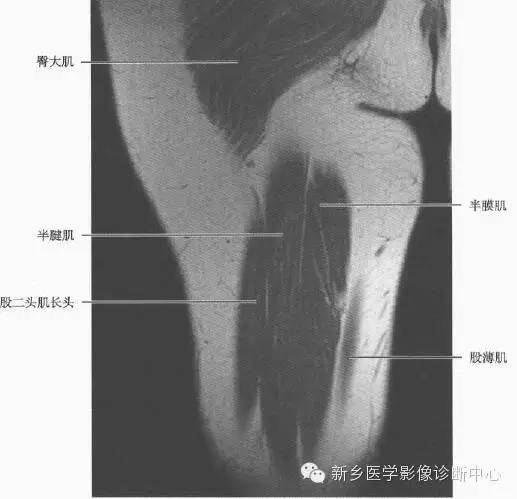 大腿解剖+详细标注