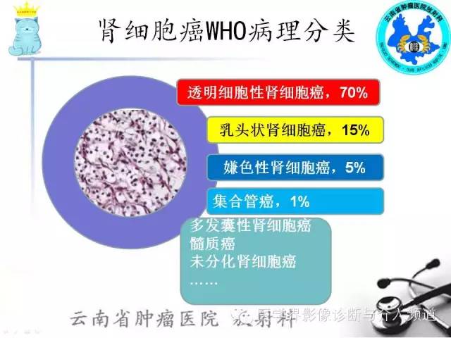 【PPT】肾细胞癌CT诊断及鉴别诊断