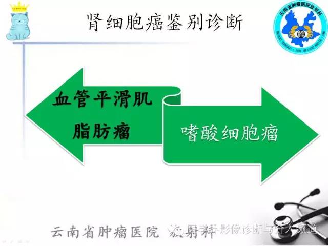 【PPT】肾细胞癌CT诊断及鉴别诊断