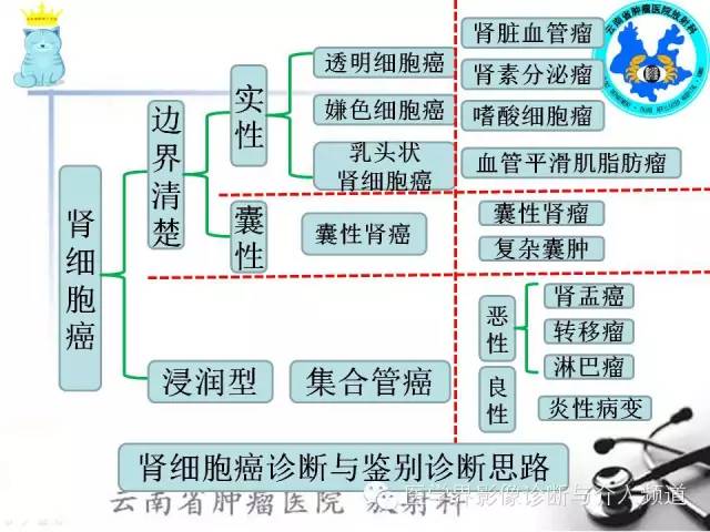 【PPT】肾细胞癌CT诊断及鉴别诊断