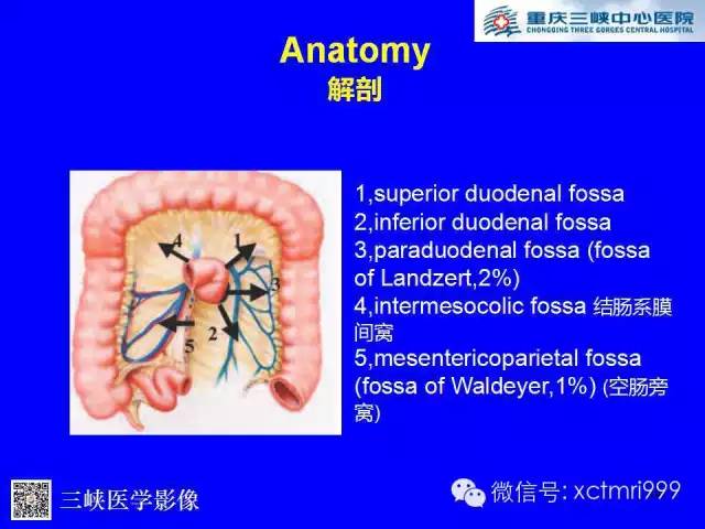 【PPT】腹内疝的影像诊断