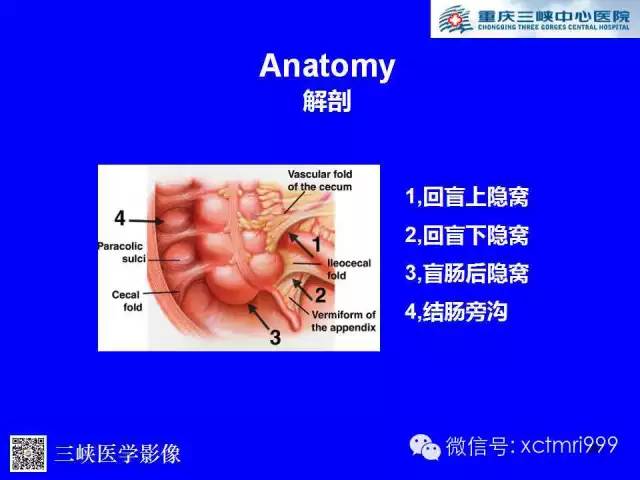 【PPT】腹内疝的影像诊断