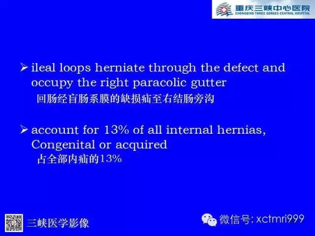 【PPT】腹内疝的影像诊断