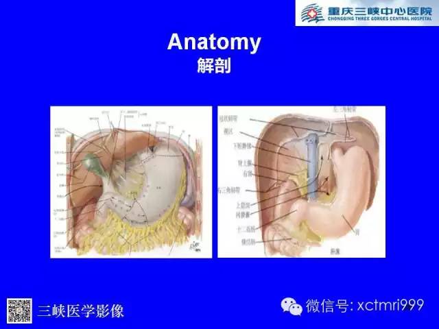 【PPT】腹内疝的影像诊断