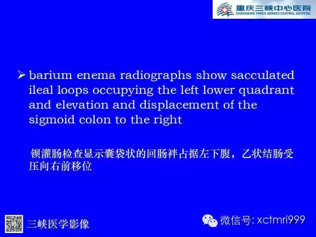 【PPT】腹内疝的影像诊断