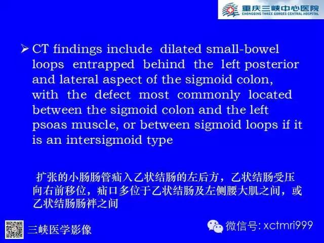 【PPT】腹内疝的影像诊断