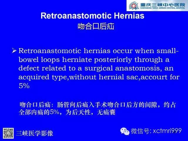 【PPT】腹内疝的影像诊断