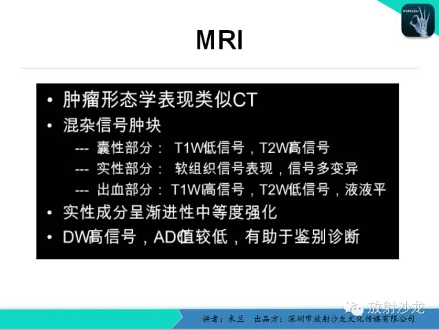 【PPT】少女瘤-胰腺实性-假乳头状瘤