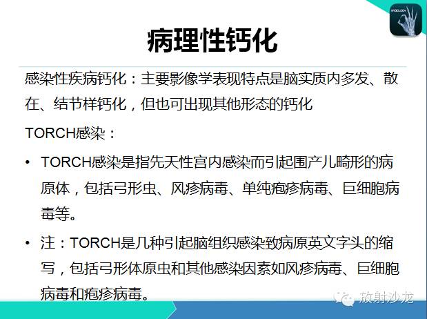 【PPT】颅内钙化常见疾病影像诊断