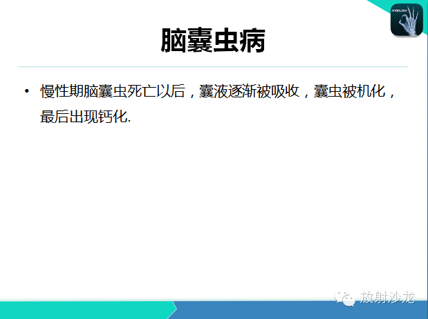 【PPT】颅内钙化常见疾病影像诊断