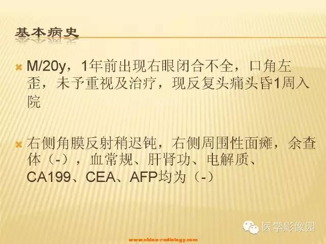 【病例】三叉神经鞘瘤1例CT及MR影像表现