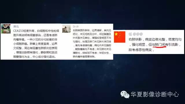 【病例】肺肉瘤样癌1例CT影像表现