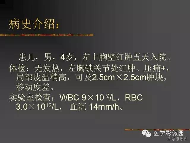【病例】锁骨朗格汉斯细胞组织细胞增生症1例影像表现