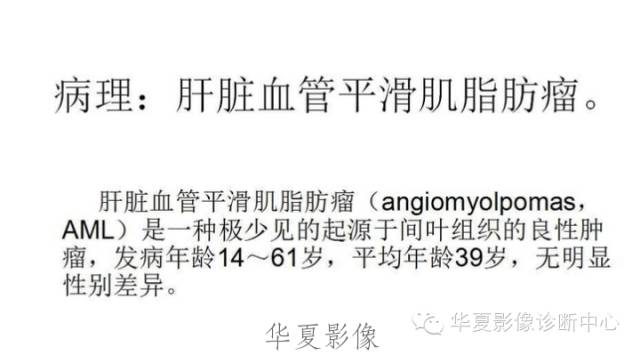 【病例】肝脏血管平滑肌脂肪瘤1例CT影像表现