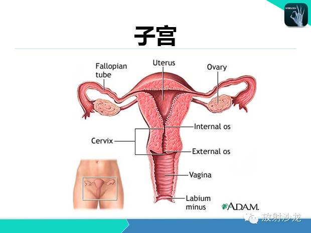 【PPT】宫颈癌MRI诊断在临床中的应用