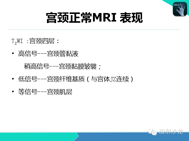 【PPT】宫颈癌MRI诊断在临床中的应用