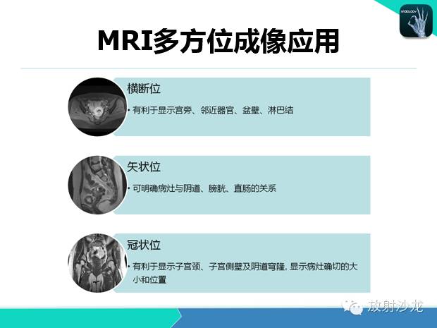 【PPT】宫颈癌MRI诊断在临床中的应用