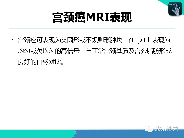 【PPT】宫颈癌MRI诊断在临床中的应用