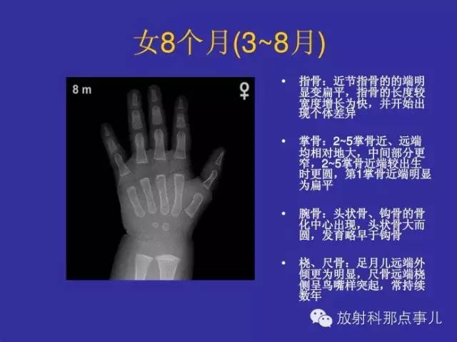 【PPT】正常女性骨龄图谱