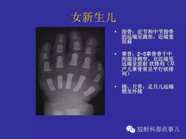 【PPT】正常女性骨龄图谱