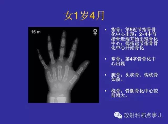 【PPT】正常女性骨龄图谱