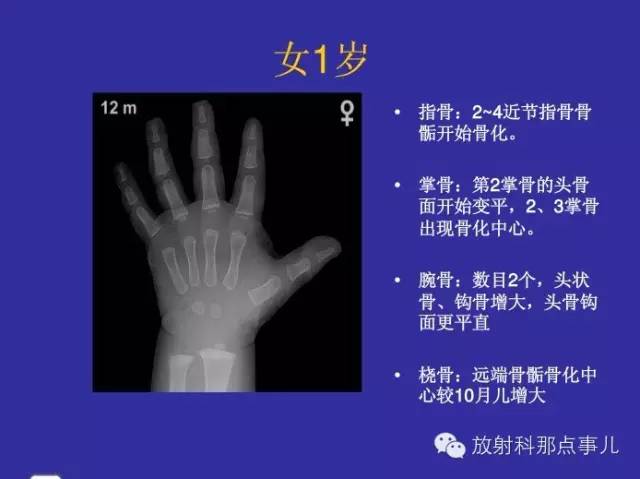 【PPT】正常女性骨龄图谱