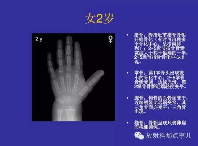 【PPT】正常女性骨龄图谱
